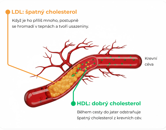 Ilustrace LDL a HDL cholesterolu v cévě